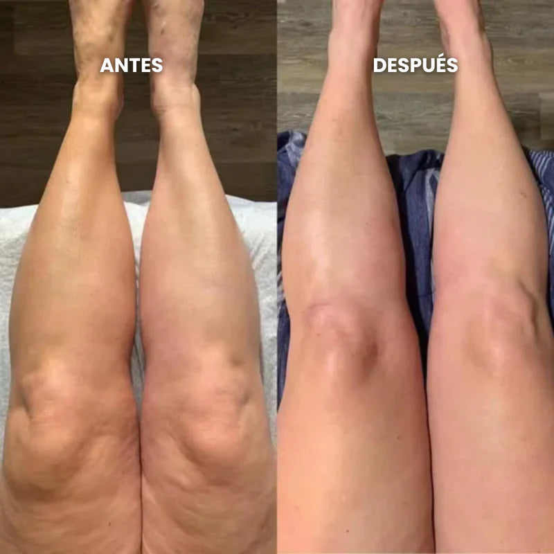 Aurelys™ Drenaje Linfatico | Piernas Ligeras en 7 Días — sin dietas, sin masajes, sin esfuerzo