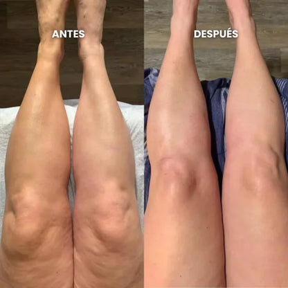 Aurelys™ Drenaje Linfatico | Piernas Ligeras en 7 Días — sin dietas, sin masajes, sin esfuerzo