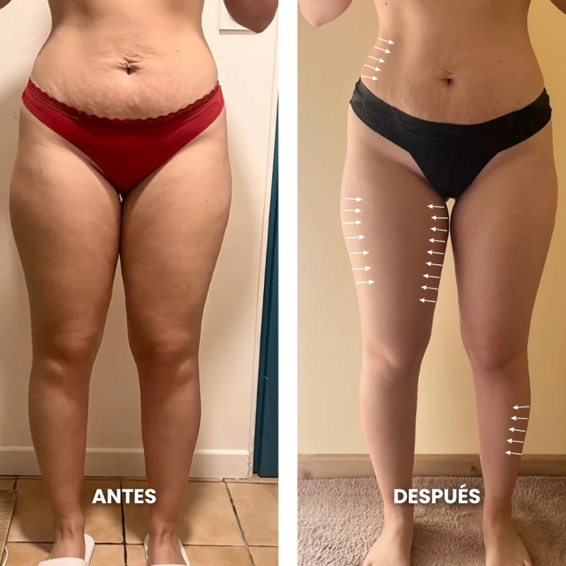 Aurelys™ Drenaje Linfatico | Piernas Ligeras en 7 Días — sin dietas, sin masajes, sin esfuerzo