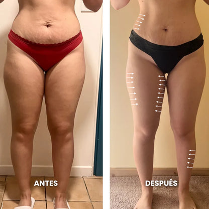 Aurelys™ Drenaje Linfatico | Piernas Ligeras en 7 Días — sin dietas, sin masajes, sin esfuerzo