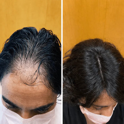 Luneria - Detiene la Caída del Pelo y Estimula el Crecimiento de Raíz