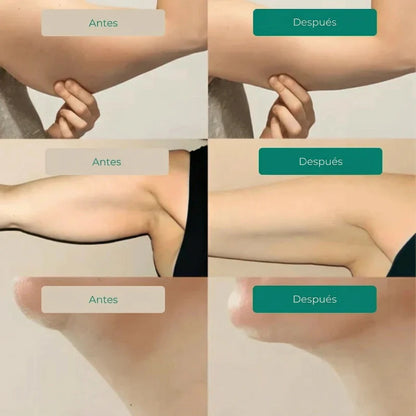 Aurelys™ Drenaje Linfatico | Piernas Ligeras en 7 Días — sin dietas, sin masajes, sin esfuerzo
